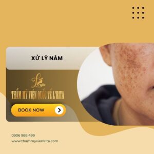 XỬ LÝ NÁM